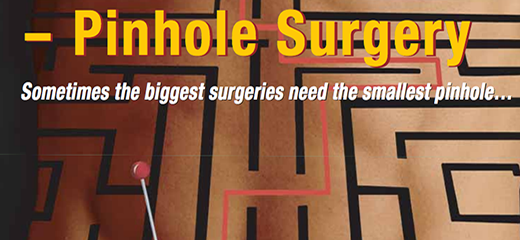 Pinhole Surgery – A Revolution in Medicine