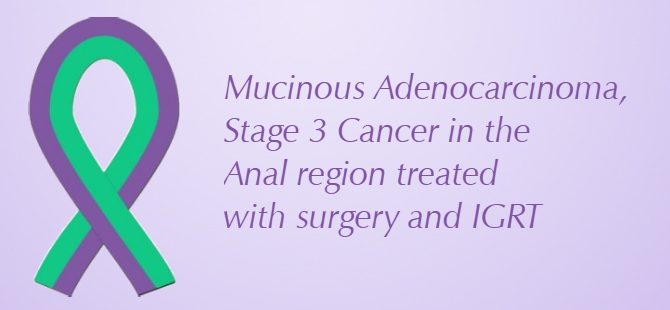 Mucinous Adenocarcinoma, Stage 3 Cancer in the Anal region treated with surgery and IGRT