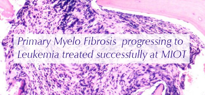 Primary Myelo Fibrosis progressing to Leukemia treated successfully at MIOT