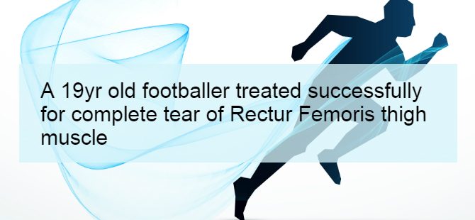 A 19yr old footballer treated successfully for complete tear of Rectur Femoris thigh muscle