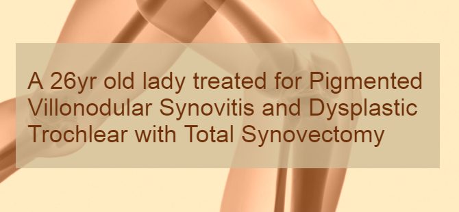 A 26yr old lady treated for Pigmented Villonodular Synovitis and Dysplastic Trochlear with Total Synovectomy
