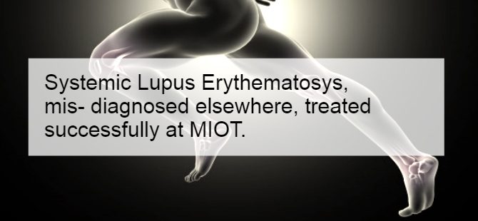 A case of Systemic Lupus Erythematosys, mis- diagnosed elsewhere, treated successfully at MIOT