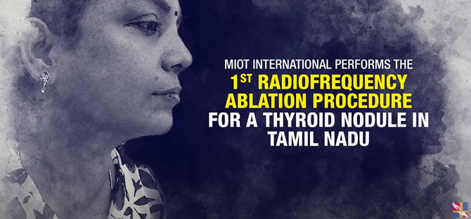 MIOT Hospitals performs 1st Radiofrequency Ablation Procedure for a Thyroid Nodule in Tamil Nadu