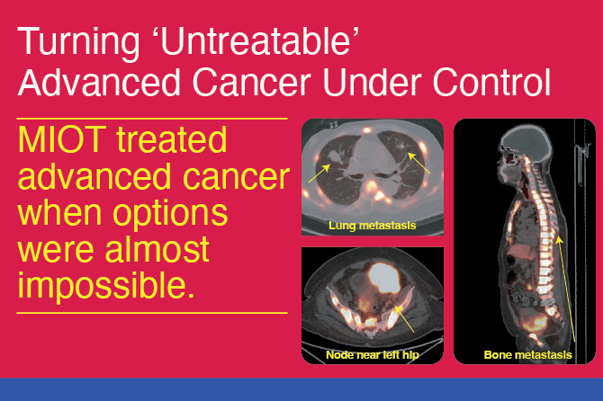 Redefining Advanced Cancer Care at MIOT