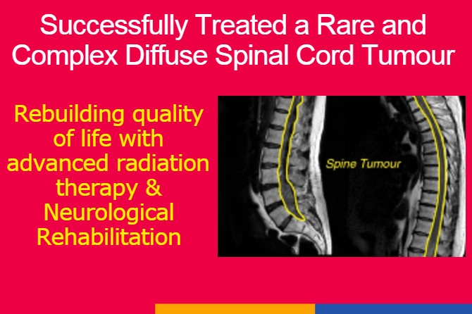 Restoring Mobility and Quality of Life through Advanced Radiation Therapy and Neurorehabilitation