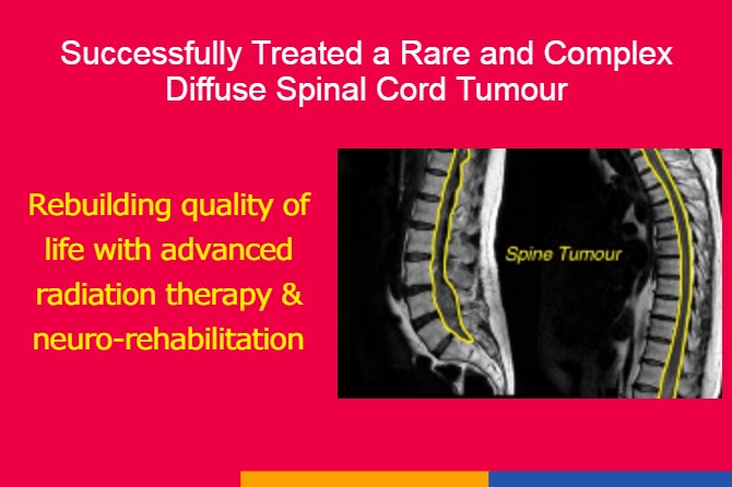 Restoring Mobility and Quality of Life through Advanced Radiation Therapy and Neurorehabilitation